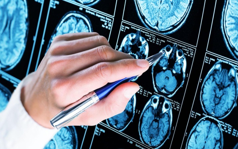 Descubren papel crucial de los condensados de una proteína en el autismo