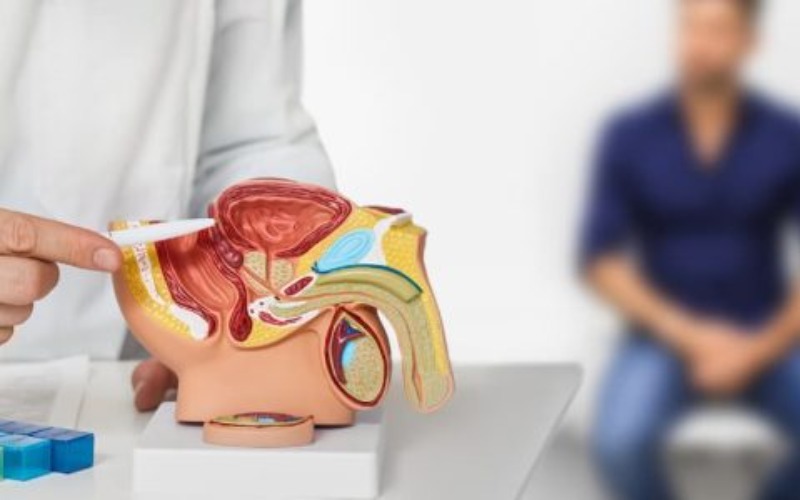 Dos de cada 10 hombre tiene cáncer de próstata en Venezuela